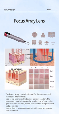 Tout en une épilation laser en picosecondes et ND YAG machine d'épilation laser de tatouage