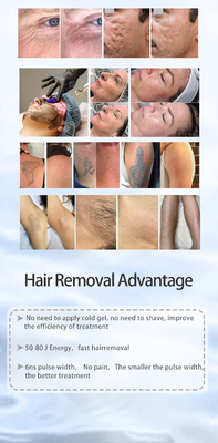 Tout en une épilation laser en picosecondes et ND YAG machine d'épilation laser de tatouage