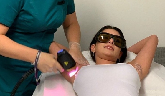 3 ondes machine laser professionnelle dépilateur de cheveux machine pour le salon