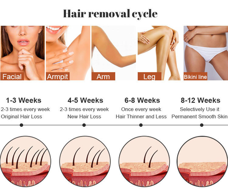 Salons de beauté IPL Machine laser épilation RF soins de la peau épilation de tatouage