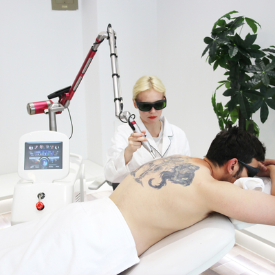 OEM ODM Machine personnalisée d'élimination de tatouage laser picoseconde avec écran tactile couleur de 15 pouces