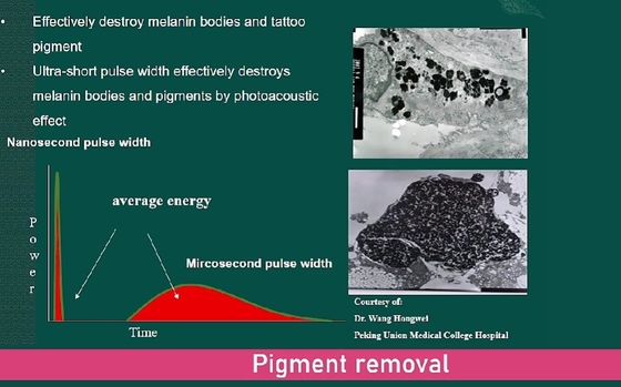 Machine laser YAG à picosecondes commerciale 3500W, appareil de détachement de tatouage laser indolore
