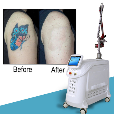 4 longueurs d'onde Nd YAG Q Switch Laser Machine Détachement de tatouage Style stationnaire