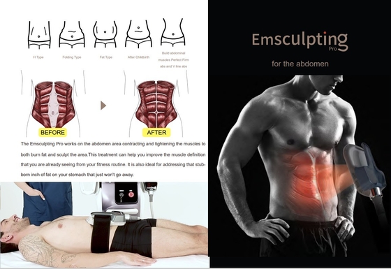Machine de minceur EMS commerciale avec écran tactile de 10 pouces pour salon de beauté / spa