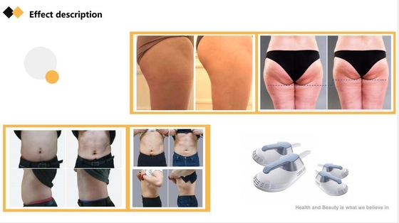 Machine de sculpture corporelle ABS EMS Stimulateur musculaire EMS électrique commercial