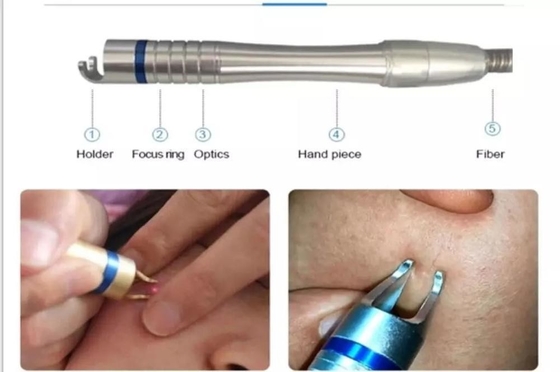 15W 30W machine d'élimination vasculaire au laser pour le traitement des ongles des pieds / rajeunissement de la peau au laser chaud