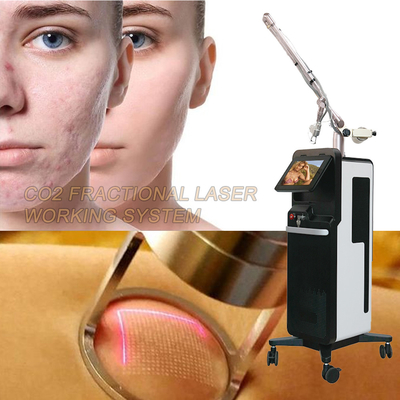 Machine à fractionner le CO2 au laser au dioxyde de carbone pour éclaircir et raffermir la peau