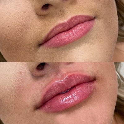 4 en 1 machine de beauté multifonctionnelle à trois longueurs d'onde laser pour éliminer les poils de tatouage