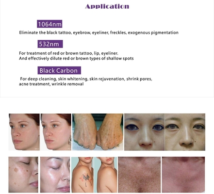 Multifonctionnel OPT IPL RF ND YAG Laser Machine épilation avec écran tactile de 15 pouces